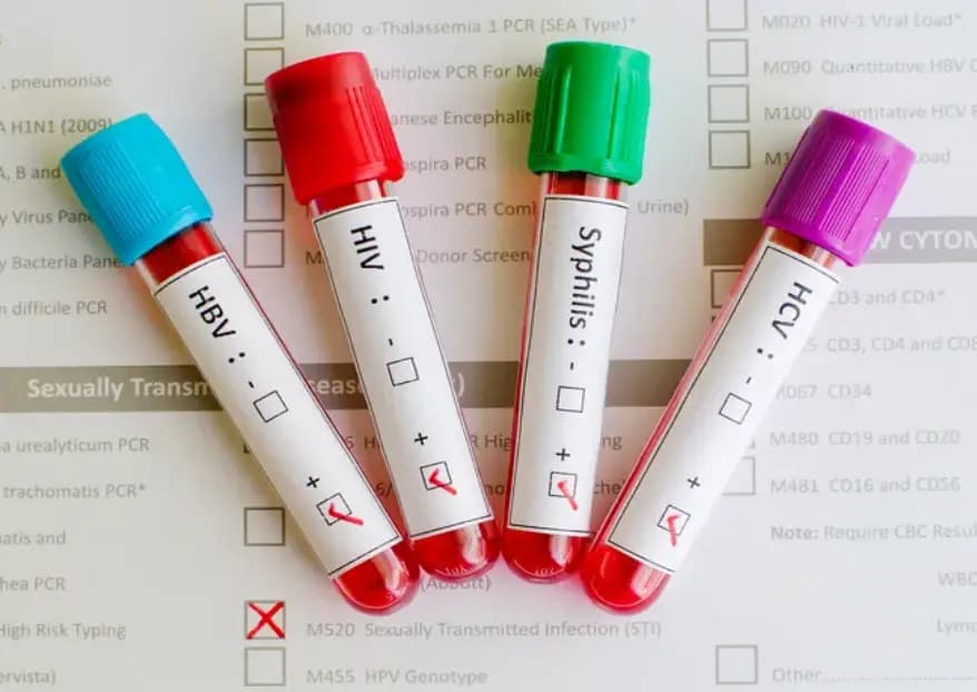 STD Blood Test: Full Panel STD Test Services in Dallas & Plano